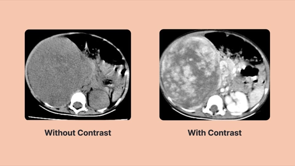 Overview of Computed Tomography